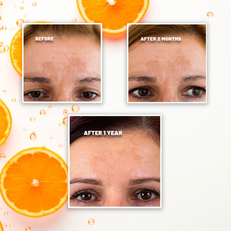 VITAMIN C10 SUPER SHOT 30 ml